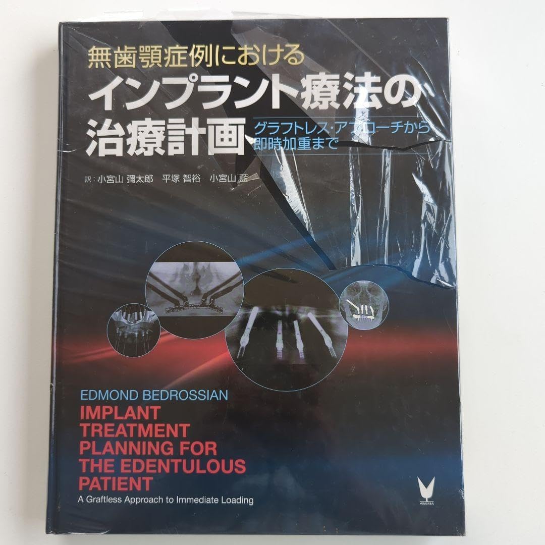無歯顎症例におけるインプラント療法の治療計画 無歯顎症例におけるインプラント療法の治遼計画 （福岡の